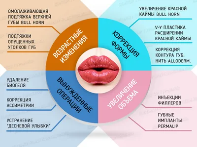 RESTYLANE KYSSE филлер 1 мл (Рестилайн Кисс) (ID#1532196975), цена: 3780 ₴,  купить на Prom.ua