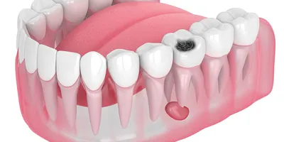 Фото примеров работ цифровой стоматологии Articon