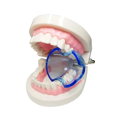 Зубной ортодонтический Ретрактор для щек, расширитель для губ,  профессиональный стоматологический ортодонтический инструмент для ухода за  зубами | AliExpress
