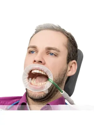 Стоматологический ретрактор-отсос для губ HVE
