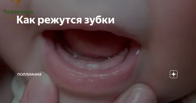 Как режутся зубки | Поллианна | Дзен