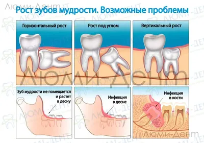 Прорезывание зубов у детей - Дентум Стоматология