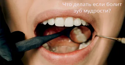 Пародонтоз: причины, симптомы, лечение | Стоматология ДентоСпас, Алтуфьево