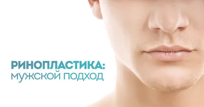Пластика носа с горбинкой - цена услуги в Минске