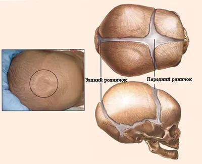 Большой родничок у ребенка - Школа Кроха