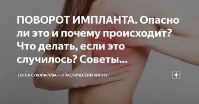 Анатомические импланты | | Motiva