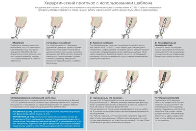 Имплантация зубов в Минске, цены - Установка импланта зуба, стоимость