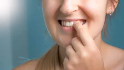 Исправление прикуса или Зачем собаке красивые зубы?