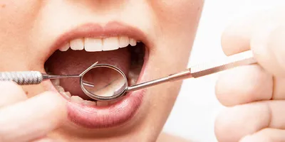 Признаки первичного иммунодефицита | if_allergist | Дзен