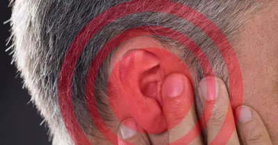 Рожистое воспаление левого уха, эритематозно-буллезная форма