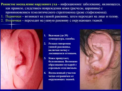 Презентация на тему: \"Острое воспаление среднего уха – заболевание  организма, местным проявлением которого является воспалительный процесс в  тканях барабанной полости, слуховой.\". Скачать бесплатно и без регистрации.