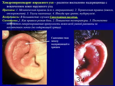 Гиперемия - покраснения на лице: лечение и профилактика в Москве - получите  консультацию косметолога в Face Clinic