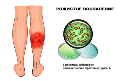 Купрум - Почему «горят» уши? Думаете, это потому, что кто-то вспоминает? А  вот и нет! Обычно беспокоиться не о чем, но иногда требуется медицинская  помощь. Вот причины, по которым уши могут «гореть»,