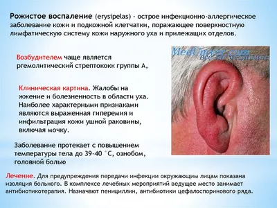 Экзема ушной раковины или наружного слухового прохода, лечение в Москве