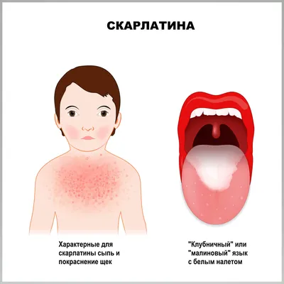 Ограниченный наружный отит - дифференциальная диагностика и подходы к  терапии – тема научной статьи по клинической медицине читайте бесплатно  текст научно-исследовательской работы в электронной библиотеке КиберЛенинка