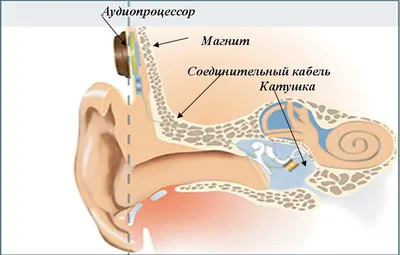 Перфорация перепонки - чем опасна, как проявляется и как лечить?