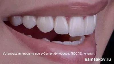 Открываем секрет успеха: как форма зубов может изменить жизнь