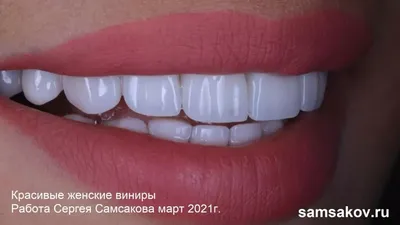 Как форма коронок зубов сделает вас моложе и привлекательнее | Альянс  бьюти-ортопедов, Москва