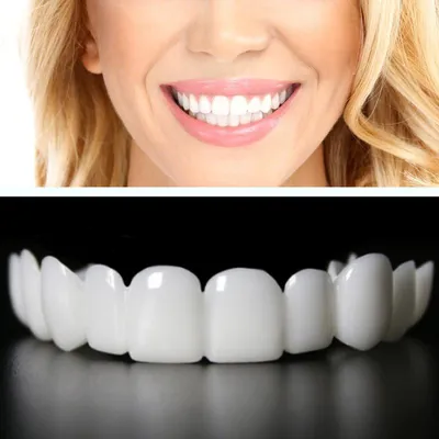 Выравнивание зубов и эстетическое протезирование керамикой