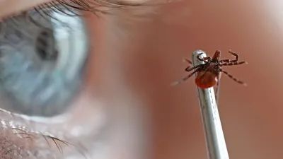 Укус клеща: симптомы, признаки, последствия и что делать после укуса