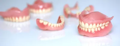 Новое поколение зубных протезов без неба: виды, фото и отзывы -  Стоматология Эспадент