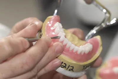 Зубные протезы: виды, способы фиксации, материалы изготовления