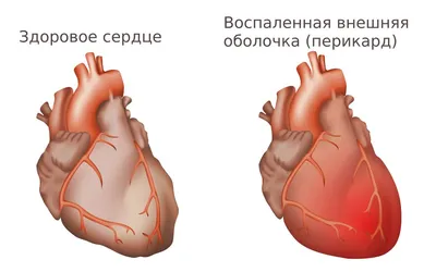 Сердце крупной собаки, как и у человека | Занимательные соб@ки | Дзен