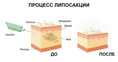 Какого...носа? | Пикабу