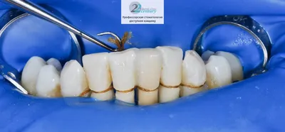 Фотографии до и после лечения зубов в Стоматологии ТариДент