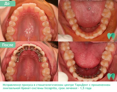 Примеры работ наших стоматологов до и после
