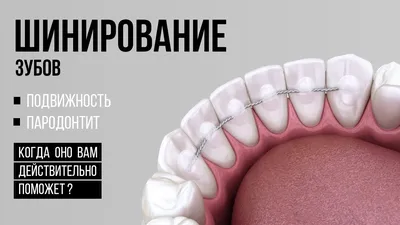 Эстетическая реставрация зубов в СПб — цены, до и после