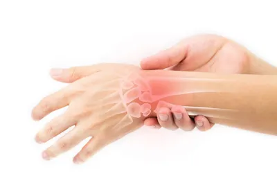 Операция по удалению фибромы кожи - «Как я удаляла фиброму - 21 день с  поднятой рукой» | отзывы