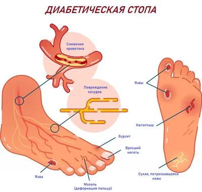 Онлайн-консультация ортопеда 2021