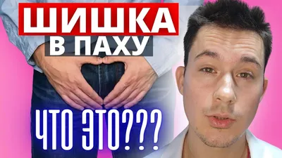 Опухоль в паху: Паховая грыжа / лимфоузел в паховой области - YouTube