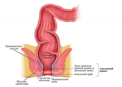 Геморрой | Семейная клиника А-Медия