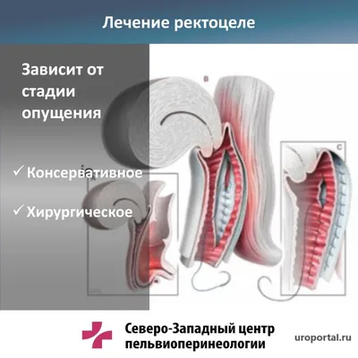 Атерома мошонки: симптомы и лечение атеромы на яичках и половом члене в  Москве