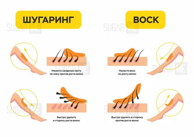 Шугаринг в Химках. Лучшие цены - ЦЕНТР ЭПИЛЯЦИИ