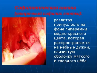 Сегодня Национальный день донора в России — где в Орехово-Зуевском округе  можно сдать кровь?