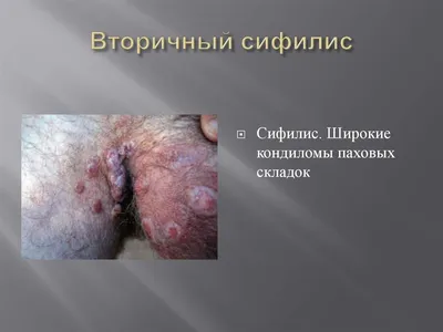 Лечение мозолей (змозолилостей) в Киеве — Derma.ua