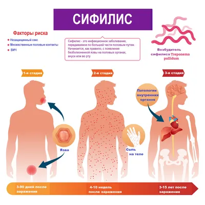 Сифилис – причины, симптомы, диагностика и способы лечения заболевания |  Клиника Будь Здоров