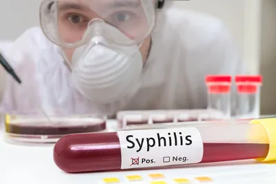 Сифилис: фото, как передается, симптомы, анализы, лечение