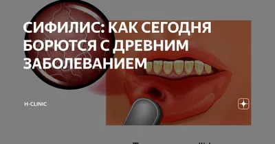 Сифилис: как передается и проявляется, стадии развития, можно ли лечить  анонимно