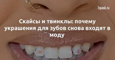 Зубные украшения в Химках | «City Smile»