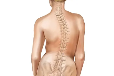 Особенности правостороннего и левостороннего сколиоза. Доктор Позвонков