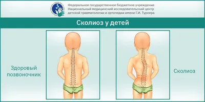 Хелз Лайф - Медицинский центр в Калининграде - ✓ Сколиоз бывает двух видов:  С-образный сколиоз (право- и левосторонний сколиоз) и S-образный сколиоз. ✓  Лечится сколиоз долго – это постоянный труд, но при