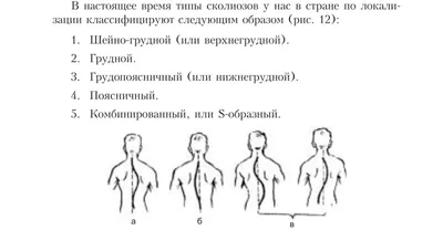 Сколиоз у подростка: что это, признаки, симптомы, диагностика и лечение