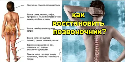 Причины сколиоза и его комплексное лечение в клинике БИЭМ Москва