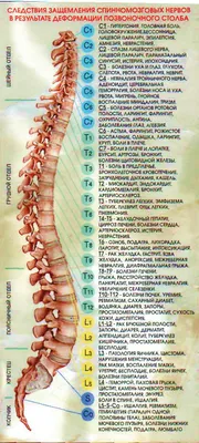 Лечение смещения позвонков