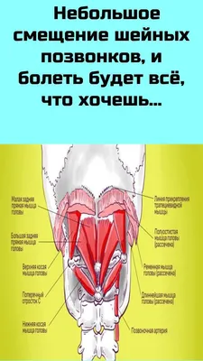 Смещение шейных позвонков: определение, симптомы и лечение для взрослых и  детей