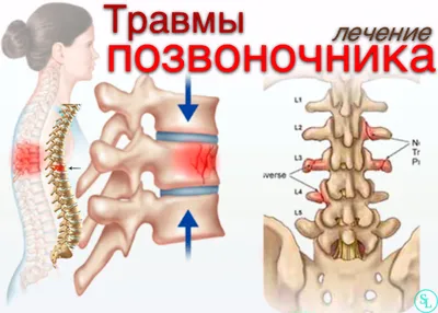 Аномалии шейного отдела позвоночника. Синдром Клиппеля-Фейля